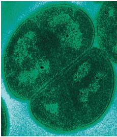 Synergies entre une technologie US d’expansion des fibres lignocellulosiques et le deinocoque dans la production de bioéthanol